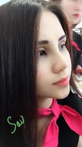 Kinh nghiệm cần biết trước và sau khi phẩu thuật nâng mũi