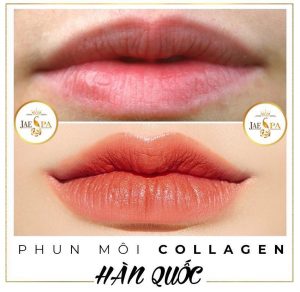 phun môi collagen đẹp nhất Bình Dương